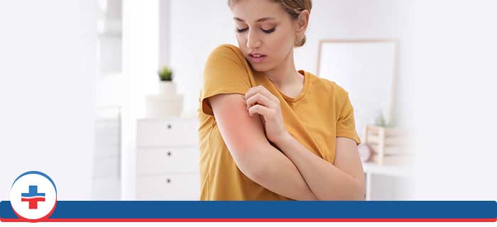 Rash and Allergic Reaction Treatment Questions and Answers Rash and Allergic Reaction Treatment Questions and Answers
