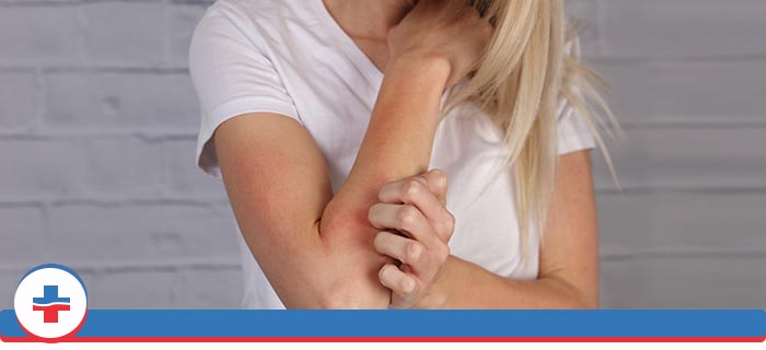 Urticaria (Hives) Treatment Specialist Near Me in Portland OR and Tigard OR Urticaria (Hives) Treatment Specialist Near Me in Portland OR and Tigard OR