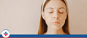 Shingles Treatment Specialist Near Me in Portland OR, and Tigard OR Shingles Treatment Specialist Near Me in Portland OR, and Tigard OR