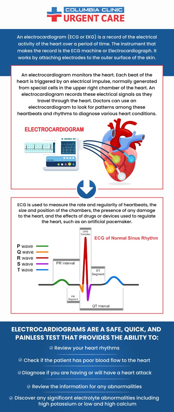 Columbia Clinic Urgent Care Offers Walk-in EKG so That We Can Diagnose and Treat Your Heart Symptoms Quickly and Efficiently. For more information, please call us or request an appointment online. We have convenient locations to serve you in 82nd Avenue Portland OR, Mall 205 Portland OR and Tigard OR.