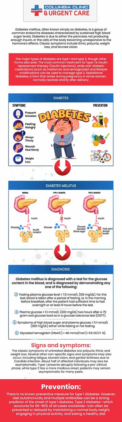 Diabetes is a disease that results when blood sugar levels in the body are too high. There are different types of diabetes that need to be treated. Type1 diabetes develops because your body does not produce insulin. Serving Patients From PDX, Portland OR, Happy Valley OR, Tigard OR, Clackamas OR, Milwaukie OR, Cedar Hills OR, Cedar Mill OR, Lake Oswego OR, Oak Grove OR, Vancouver WA, Aloha OR, Minnehaha WA, Gladstone OR, Tualatin OR, West Linn OR, Fairview OR, Oregon City OR.