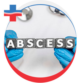 Abscess Treatment in Portland, OR