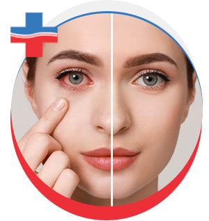 Pink Eye Treatment in Portland, OR