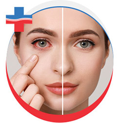 Pink Eye Treatment in Portland, OR
