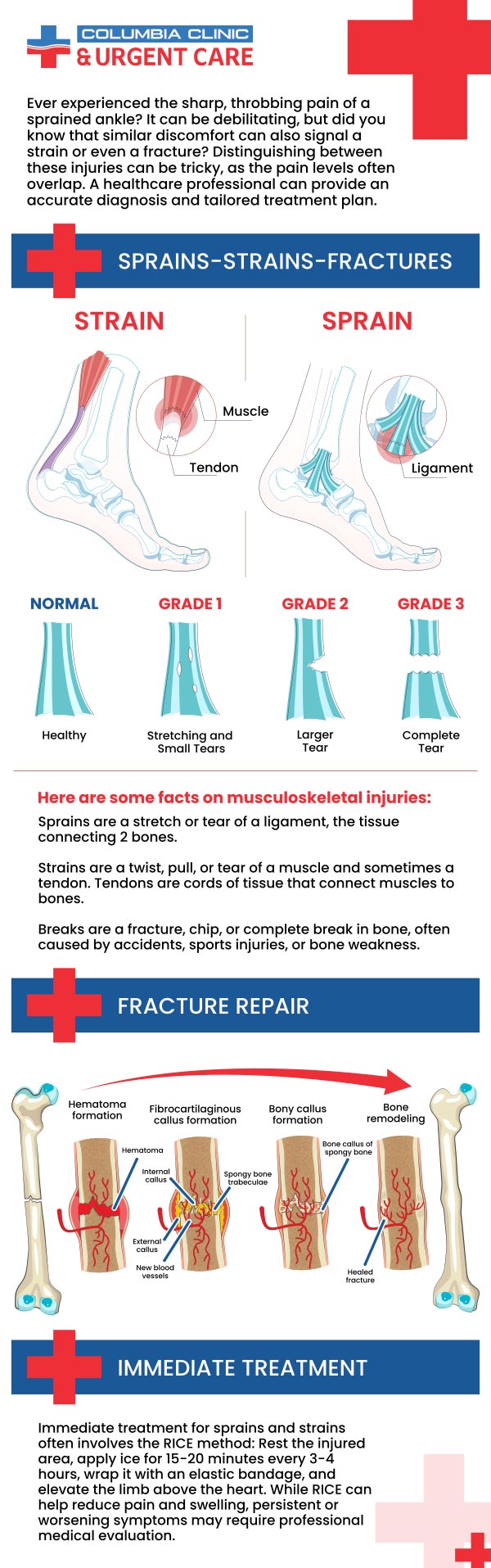 A fracture is a crack or break in the bone. Bone fracture symptoms include soreness, bruising, swelling, and deformity. If you are looking for a clinic near you that provides exceptional fracture treatment, we invite you to come to Columbia Clinic Urgent Care! For more information, please contact us or book an appointment online. We have convenient locations to serve you in Portland at 82nd Avenue Portland OR and Mall 205 Portland OR. A fracture is a crack or break in the bone. Bone fracture symptoms include soreness, bruising, swelling, and deformity. If you are looking for a clinic near you that provides exceptional fracture treatment, we invite you to come to Columbia Clinic Urgent Care! For more information, please contact us or book an appointment online. We have convenient locations to serve you in Portland at 82nd Avenue Portland OR and Mall 205 Portland OR.