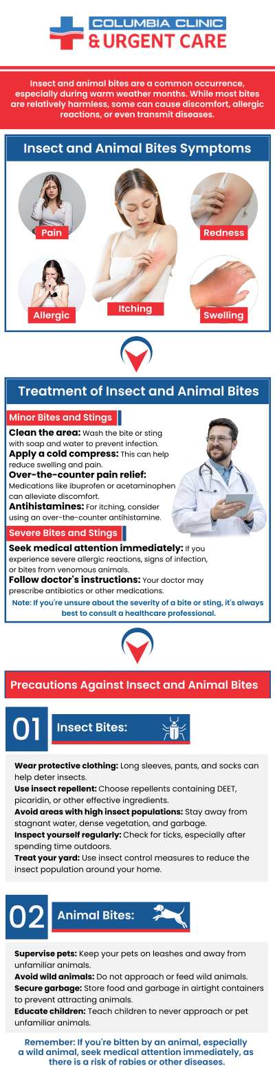 Animal and human bites can happen to anyone of any age, seeking medical treatment to help with the bite is critical as it will help your healing process and eliminate any chance of future infection and issues. Visit Columbia Clinic Urgent Care today for treatment! For more information, contact us or book an appointment online. We have convenient locations to serve you at Tibbetts St Portland, Stark Street Portland and Tigard, OR. Animal and human bites can happen to anyone of any age, seeking medical treatment to help with the bite is critical as it will help your healing process and eliminate any chance of future infection and issues. Visit Columbia Clinic Urgent Care today for treatment! For more information, contact us or book an appointment online. We have convenient locations to serve you at Tibbetts St Portland, Stark Street Portland and Tigard, OR.