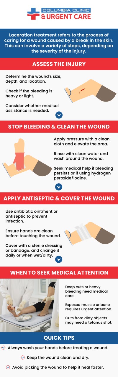 Columbia Clinic Urgent Care provides laceration repairs for cuts and wounds. We are available by walk-in or appointment 7 days a week! For more information, call us or book an appointment online. We have convenient locations to serve you at Tibbetts St Portland, Stark Street Portland and Tigard, OR. Columbia Clinic Urgent Care provides laceration repairs for cuts and wounds. We are available by walk-in or appointment 7 days a week! For more information, call us or book an appointment online. We have convenient locations to serve you at Tibbetts St Portland, Stark Street Portland and Tigard, OR.