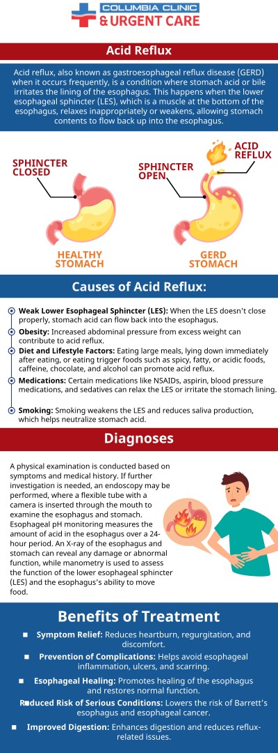 Columbia Clinic Urgent Care & Walk-in Clinic Are Ready to Help You Feel Better!  What is Reflux? Reflux Can Be Referred to by a Number of Different Names Including Gastroesophageal Reflux (GERD), Acid Indigestion, Acid Reflux, and Heartburn. Serving Patients From PDX, Portland OR, Tigard OR, Milwaukie OR, Cedar Hills OR, Cedar Mill OR, Lake Oswego OR, Oak Grove OR, Vancouver WA, Aloha OR, Minnehaha WA, Gladstone OR, Tualatin OR, West Linn OR, Fairview OR, Oregon City OR.