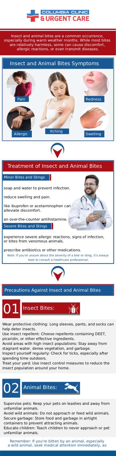 At Columbia Clinic Urgent Care, our experienced medical team is equipped to handle insect sting allergies promptly and effectively. We offer walk-in services for individuals experiencing allergic reactions to insect stings, providing immediate care to alleviate symptoms such as swelling, hives, and difficulty breathing. For more information, please contact us or book an appointment online. We have convenient locations to serve you at Tibbetts St Portland, Stark Street Portland, and Tigard, OR.