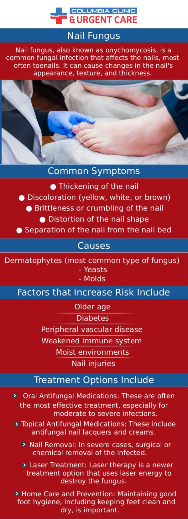 Columbia Clinic Urgent Care helps treat nail infections. If you have a nail infection and need treatment, then call us today or book an appointment online. We have convenient locations to serve you at Tibbetts St Portland, Stark Street Portland and Tigard, OR.