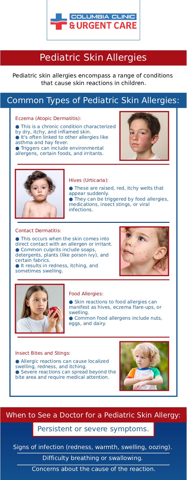 Allergic reactions in children should not be mishandled, make sure you put your child’s allergic reaction treatment in the right hands, visit Columbia Clinic Urgent Care for any of your child’s allergic reactions for treatment, and helpful information about their allergies. For more information call us or visit us online to book an appointment. We have convenient locations to serve you at Tibbetts St Portland, Stark Street Portland and Tigard, OR.
