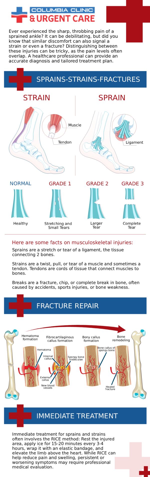 A muscle strain can happen when it is stretched or torn as a result of excessive use, improper use, or sudden activity. Pain, edema, weakness, stiffness, and trouble moving the affected area are all common symptoms of a strained muscle. Muscle strains can result in additional damage and chronic discomfort if they are not treated. An urgent care center can offer treatment for a muscle strain that can reduce discomfort and inflammation, increase range of motion and flexibility, and hasten healing time. At Columbia Urgent Care Clinic, we offer treatment for muscle strains. For more information, contact us or schedule an appointment online. We have convenient locations to serve you at Tibbetts St Portland, Stark Street Portland and Tigard, OR.