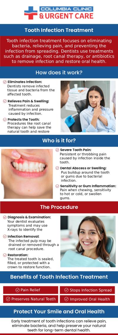A tooth infection, often known as a dental abscess, begins when germs enter the pulp, the tooth's innermost layer. A tooth infection can cause intense toothache, swelling of the gums or face, a high fever, a bad taste or odor in the mouth, and trouble eating or biting. If left untreated, a tooth infection might cause serious problems. If you have a tooth infection, come to Columbia Clinic Urgent Care, we can help you prevent infection. For more information, please contact us or book an appointment online. We have convenient locations to serve you at Stark Street Portland and Tigard, OR.