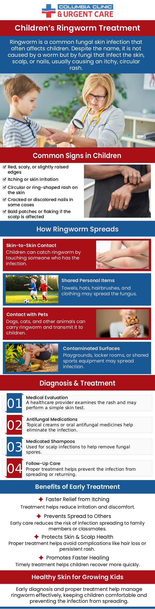 Ringworm is a common fungal infection affecting children, causing discomfort and spreading quickly if not addressed. Protect your child by practicing good hygiene, avoiding sharing personal items, and keeping their skin clean and dry. If you suspect ringworm, visit Columbia Clinic Urgent Care today for expert diagnosis and effective treatment. We also accept walk-ins. For more information, please contact us or request an appointment online. We have convenient locations to serve you at Tibbetts St Portland, Stark Street Portland, and Tigard, OR.
