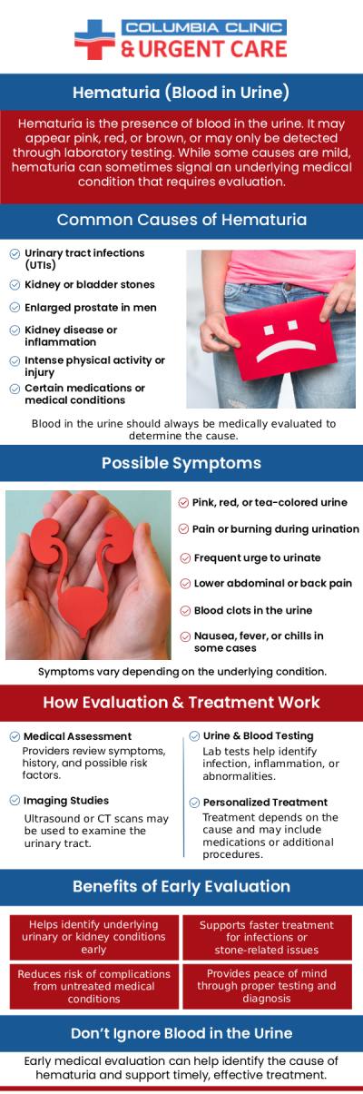 If you are showing symptoms of hematuria, don’t delay it and get a thorough checkup from Columbia Clinic Urgent Care today. For more information, call us or book an appointment online. We have convenient locations to serve you in 82nd Avenue Portland OR, Mall 205 Portland OR and Tigard OR. If you are showing symptoms of hematuria, don’t delay it and get a thorough checkup from Columbia Clinic Urgent Care today. For more information, call us or book an appointment online. We have convenient locations to serve you in 82nd Avenue Portland OR, Mall 205 Portland OR and Tigard OR.